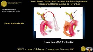 Primary Biliary Cholangitis Overview Diagnosis and Treatment Options [upl. by Kurland]