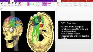 Frontal Lobe Circuits 3 Orbitofrontal Cortex OFC [upl. by Burney522]