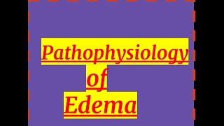 PATHOLOGY OF EDEMA [upl. by Alauqahs120]