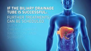 Biliary Drain [upl. by Yobybab407]